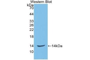 Detection of Recombinant ENG, Rat using Monoclonal Antibody to Endoglin (ENG) (Endoglin Antikörper  (AA 26-136))