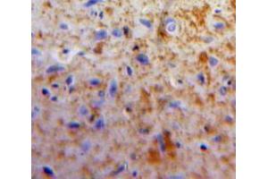 Used in DAB staining on fromalin fixed paraffin-embedded Brain tissue (Apelin Antikörper  (AA 24-77))