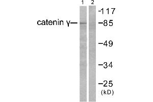 Western blot analysis of extracts from HeLa cells, using Catenin-γ antibody. (JUP Antikörper)