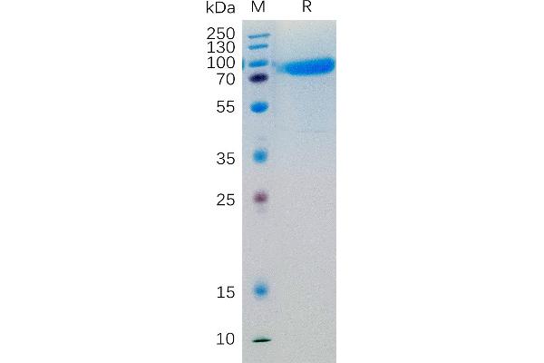 IL-6 Receptor Protein (AA 20-365) (Fc Tag)