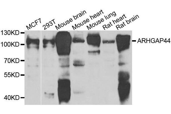 ARHGAP44 Antikörper  (AA 666-772)