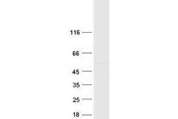 ZNF385A Protein (Transcript Variant 3) (Myc-DYKDDDDK Tag)