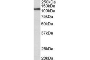 AP31686PU-N (0. (Thyroperoxidase Antikörper  (Internal Region))