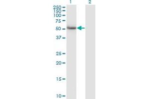 Western Blot analysis of CALCOCO2 expression in transfected 293T cell line by CALCOCO2 monoclonal antibody (M07), clone 1A11. (CALCOCO2 Antikörper  (AA 347-446))