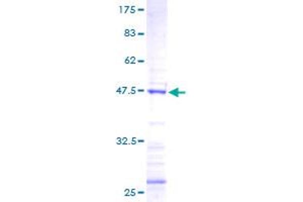 FGF18 Protein (AA 29-207) (GST tag)