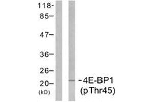 Western blot analysis of extracts from MDA-MB-435 cells treated with EGF 200ng/ml 5', using 4E-BP1 (Phospho-Thr45) Antibody. (eIF4EBP1 Antikörper  (pThr46))