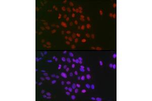 Immunofluorescence analysis of U-2 OS cells using Symmetric DiMethyl-Histone H3-R26 Rabbit pAb (ABIN3017473, ABIN3017474, ABIN3017475 and ABIN6220103) at dilution of 1:100 (40x lens). (Histone 3 Antikörper  (H3R26me2))