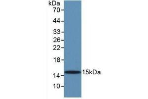 Detection of Recombinant TGFb1, Human using Monoclonal Antibody to Transforming Growth Factor Beta 1 (TGFb1) (TGFB1 Antikörper  (AA 279-390))