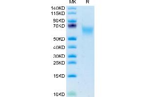 CADM1 Protein (AA 45-374) (His tag)