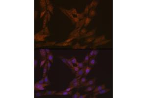 Immunofluorescence analysis of NIH-3T3 cells using KIFC1 Rabbit mAb (ABIN1680485, ABIN3015039, ABIN3015040 and ABIN7101305) at dilution of 1:100 (40x lens). (KIFC1 Antikörper)
