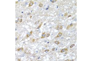 Immunohistochemistry of paraffin-embedded rat brain using HSPA6 antibody. (HSPA6 Antikörper)