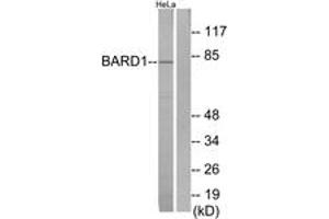 Western Blotting (WB) image for anti-BRCA1 Associated RING Domain 1 (BARD1) (AA 1-50) antibody (ABIN2889977) (BARD1 Antikörper  (AA 1-50))