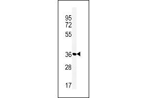 Western blot analysis of MFRN2 Antibody (N-term) (ABIN651437 and ABIN2840240) in Jurkat cell line lysates (35 μg/lane). (SLC25A28 Antikörper  (N-Term))