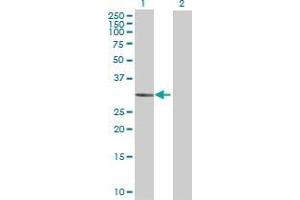 Lane 1: NMNAT1 transfected lysate ( 30. (NMNAT1 293T Cell Transient Overexpression Lysate(Denatured))