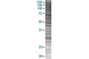 ADAM12 transfected lysate. (ADAM12 293T Cell Transient Overexpression Lysate(Denatured))