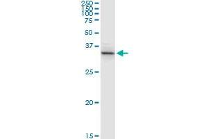 ACAT2 MaxPab rabbit polyclonal antibody. (ACAT2 Antikörper  (AA 1-397))