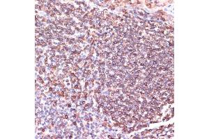 Immunohistochemistry of paraffin-embedded human tonsil using TPD52 antibody  at dilution of 1:100 (40x lens). (TPD52 Antikörper  (AA 1-184))