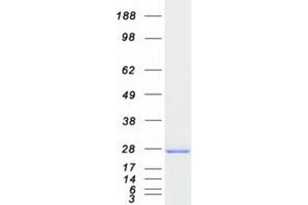 CSNK2B Protein (Myc-DYKDDDDK Tag)