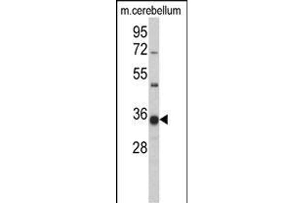 GGPS1 Antikörper  (C-Term)