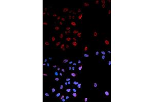 Immunofluorescence analysis of U2OS cells using Phospho-MYC-S62 antibody (ABIN5969927). (c-MYC Antikörper  (pSer62))