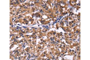 Immunohistochemistry (IHC) image for anti-Selectin P Ligand (SELPLG) antibody (ABIN2422075) (SELPLG Antikörper)
