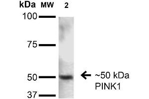 Western Blot analysis of Rat Brain showing detection of ~50 kDa PINK1 protein using Mouse Anti-PINK1 Monoclonal Antibody, Clone S4-15 . (PINK1 Antikörper  (AA 112-496) (APC))