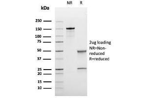 SDS-PAGE Analysis Purified BCL-6 Mouse Recombinant Monoclonal Antibody (rBCL6/1718). (Rekombinanter BCL6 Antikörper  (AA 256-389))