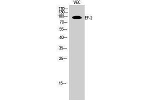 Western Blotting (WB) image for anti-Eukaryotic Translation Elongation Factor 2 (EEF2) (Ser311) antibody (ABIN3174881) (EEF2 Antikörper  (Ser311))