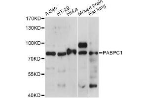 Western blot analysis of extracts of various cell lines, using PABPC1 antibody. (PC1 Antikörper)