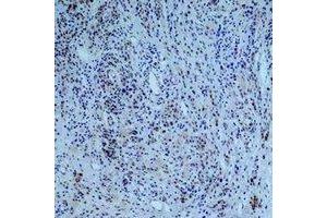 Immunohistochemical analysis of Collagen 3 alpha 1 staining in human skin formalin fixed paraffin embedded tissue section. (COL3A1 Antikörper)