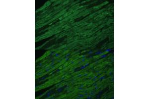 Immunofluorescence analysis of mouse heart cells using TNNI3 antibody (ABIN6132729, ABIN6149357, ABIN6149359 and ABIN6213640) at dilution of 1:100. (TNNI3 Antikörper  (AA 1-210))