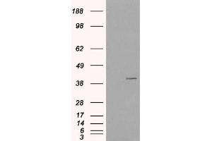 Western Blotting (WB) image for anti-Vacuolar Protein Sorting-Associated Protein 26A (VPS26A) antibody (ABIN5906188) (VPS26A Antikörper)