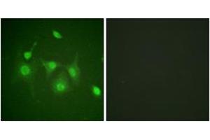 Immunofluorescence analysis of HepG2 cells, using HDAC6 (Ab-22) Antibody. (HDAC6 Antikörper  (AA 7-56))