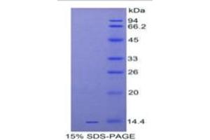 SDS-PAGE (SDS) image for Interleukin 33 (IL33) ELISA Kit (ABIN6730913)