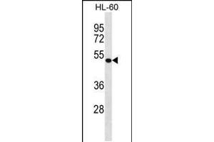 Western blot analysis in HL-60 cell line lysates (35ug/lane). (DBNL Antikörper  (C-Term))