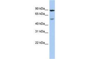 Image no. 1 for anti-Aldehyde Dehydrogenase 6 Family, Member A1 (ALDH6A1) (C-Term) antibody (ABIN6743431) (ALDH6A1 Antikörper  (C-Term))