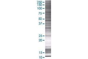 TMOD1 transfected lysate. (TMOD1 293T Cell Transient Overexpression Lysate(Denatured))