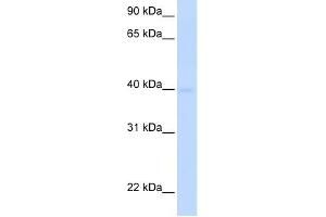 SLC25A36 antibody used at 1 ug/ml to detect target protein. (SLC25A36 Antikörper  (N-Term))