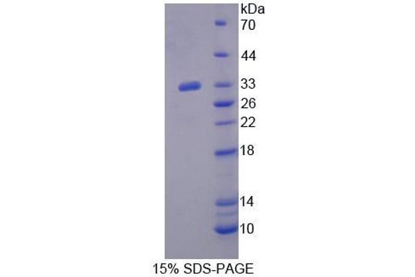 Exportin 6 Protein (XPO6)