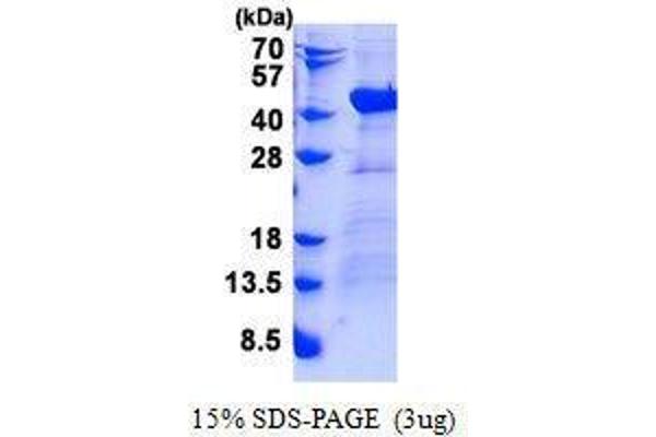 DNAJB4 Protein