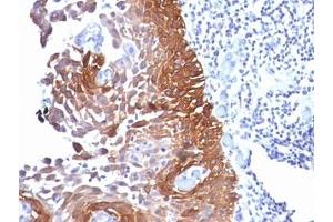 Immunohistochemistry (Formalin-fixed Paraffin-embedded Sections) (IHC (fp)) image for anti-Keratin 18 (KRT18) antibody (ABIN3026955)