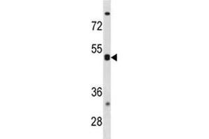 CXCR5 antibody western blot analysis in K562 lysate. (CXCR5 Antikörper  (AA 1-30))