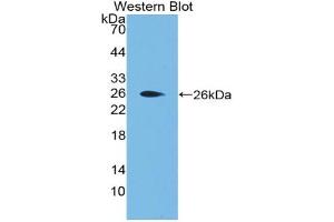 Western blot analysis of the recombinant protein. (Apolipoprotein F Antikörper  (AA 111-314))