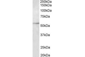 Western Blotting (WB) image for anti-Tubulin, beta 3 (TUBB3) (Internal Region) antibody (ABIN1449438) (TUBB3 Antikörper  (Internal Region))