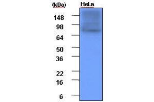 Western Blotting (WB) image for anti-Heat Shock Protein 90kDa alpha (Cytosolic), Class A Member 1 (HSP90AA1) (AA 1-732), (N-Term) antibody (ABIN317533) (HSP90AA1 Antikörper  (N-Term))