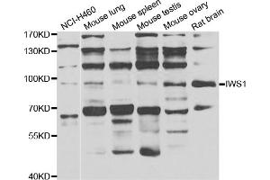 Western blot analysis of extracts of various cell lines, using IWS1 antibody (ABIN4904098) at 1:1000 dilution. (IWS1 Antikörper)