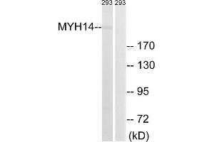 Western blot analysis of extracts from 293 cells, using MYH14 antibody. (Myosin Antikörper  (Internal Region))