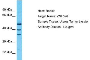 Host: Rabbit Target Name: ZNF528 Sample Type: Uterus Tumor lysates Antibody Dilution: 1. (ZNF528 Antikörper  (Middle Region))