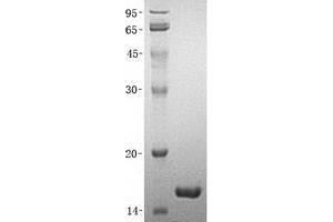 Validation with Western Blot (RPS19 Protein (His tag))