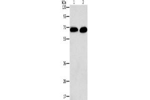 Western Blotting (WB) image for anti-Protein Kinase C, alpha (PKCa) antibody (ABIN2434183) (PKC alpha Antikörper)